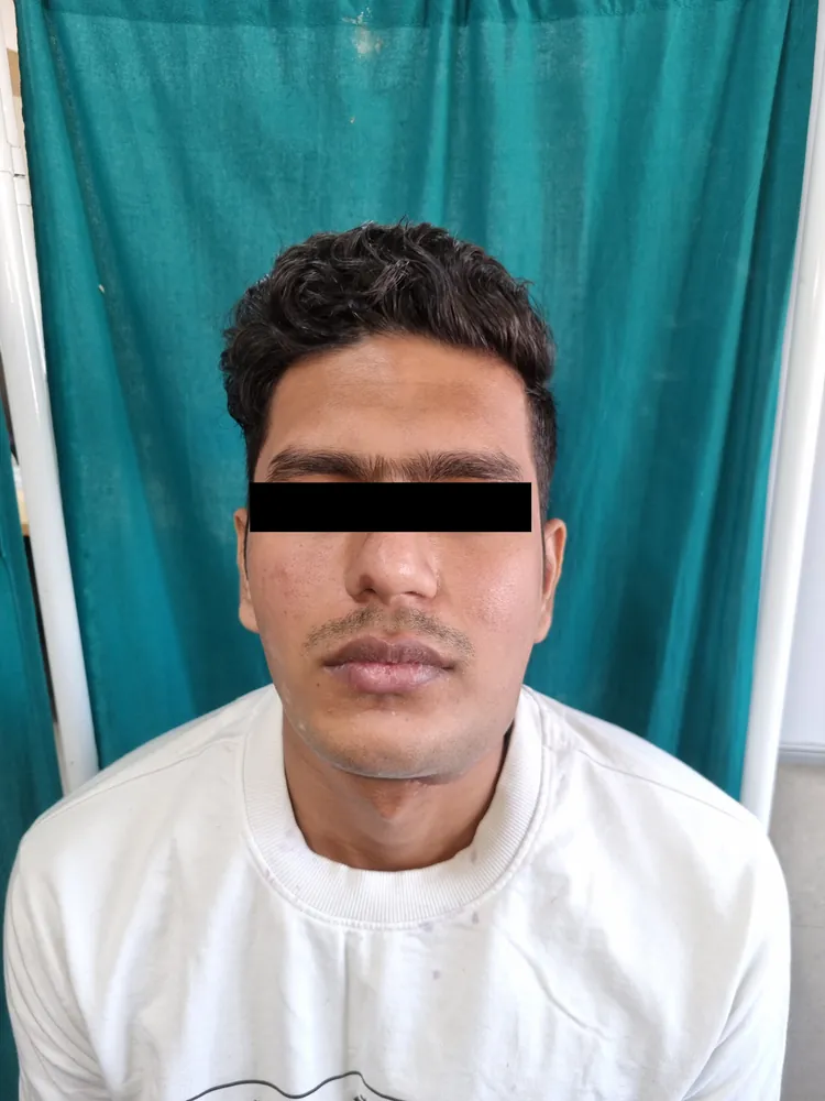 Nine weeks after surgery — jawline and facial symmetry restored.